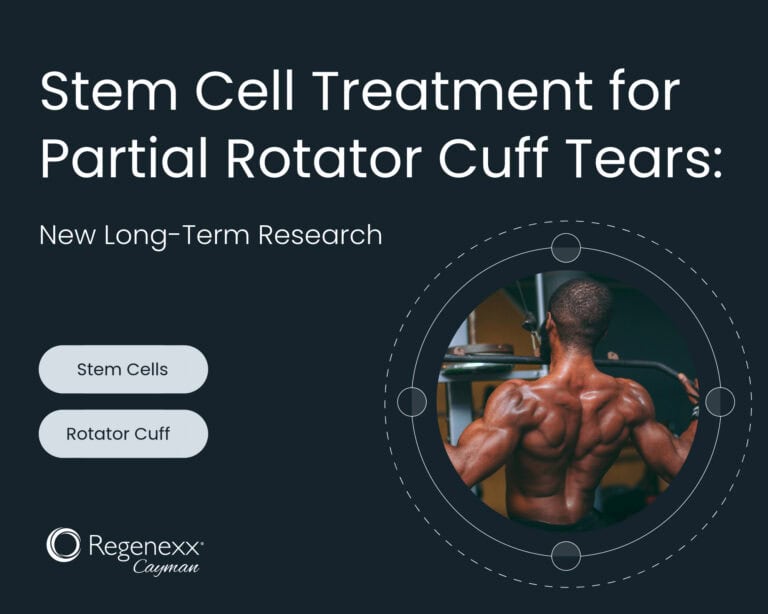 Stem cell treatment for partial rotator cuff tear: Research review
